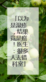 以为是湿疹，结果竟是癌！医生：很多人去错科室
